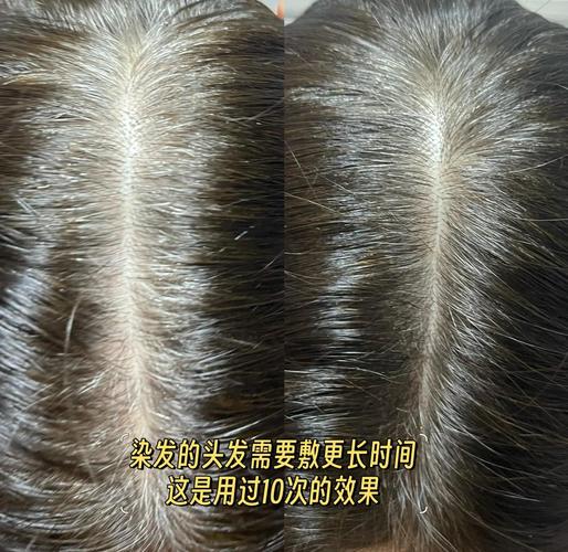 疫情扶贫图片，抗疫扶贫图片